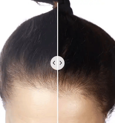Electric LED Hair Brush │ Red Blue Therapy, Scalp Care │ Black